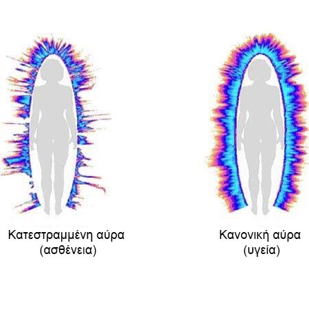 Κανονική αύρα (υγεία)